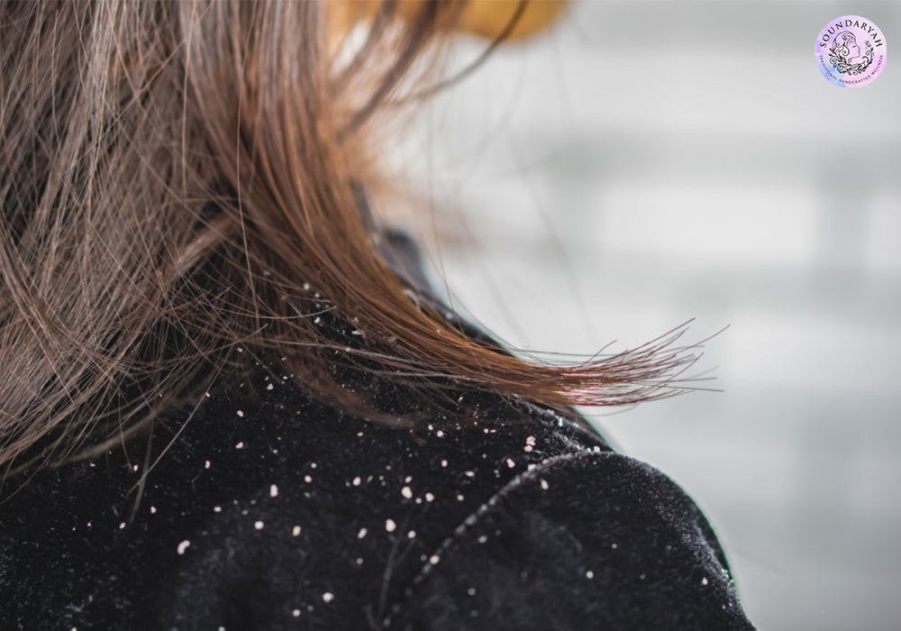 10 Effective Home Remedies for Dandruff